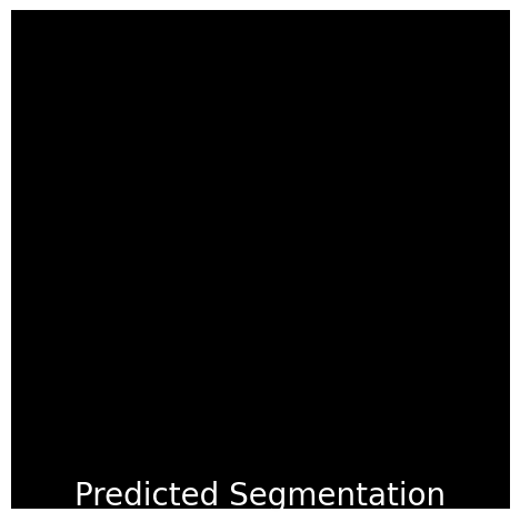 tumor_segmentation